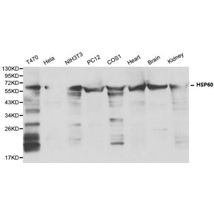 Anti-HSP60 Antibody from Bioworld Technology (BS6072) - Antibodies.com