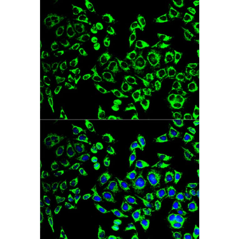 Anti-HSP60 Antibody from Bioworld Technology (BS6072) - Antibodies.com
