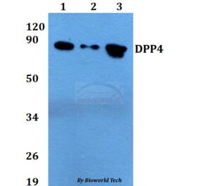 Anti-DPP4 Antibody from Bioworld Technology (BS60720) - Antibodies.com