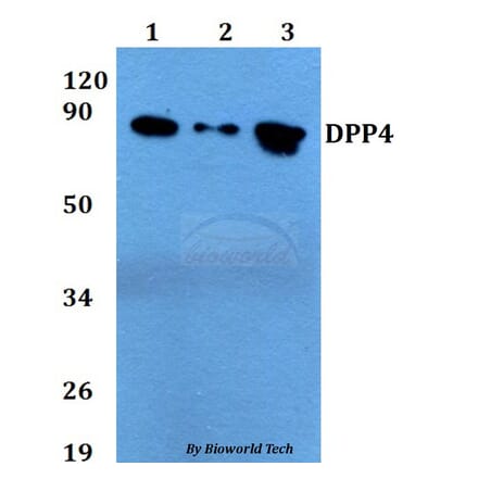 Anti-DPP4 Antibody from Bioworld Technology (BS60720) - Antibodies.com