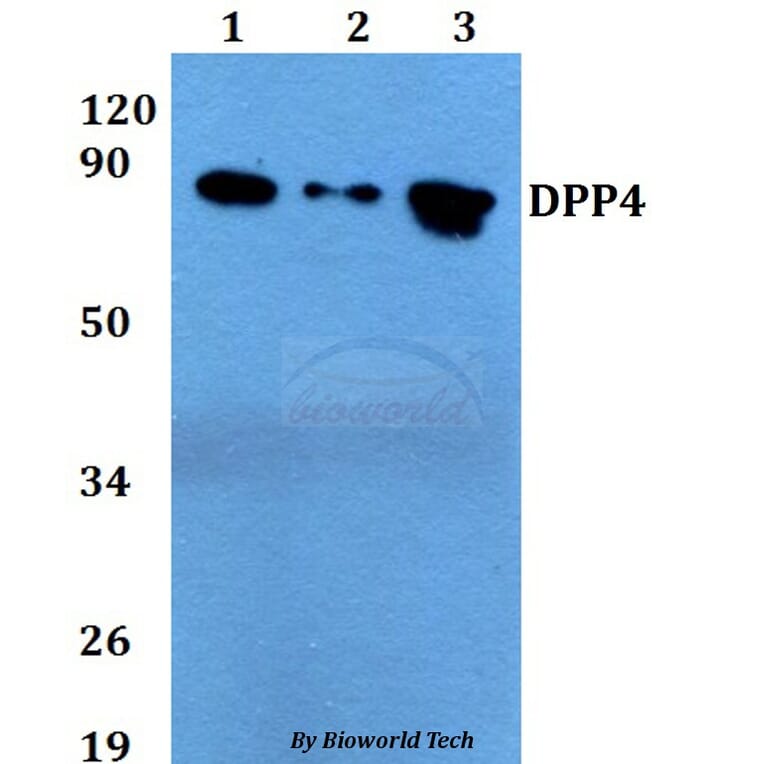 Anti-DPP4 Antibody from Bioworld Technology (BS60720) - Antibodies.com