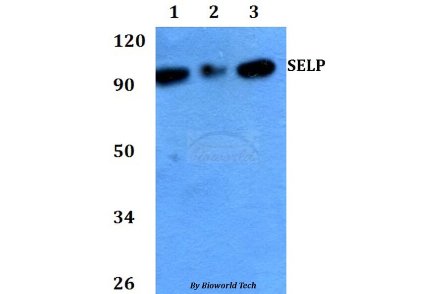 Anti-SELP Antibody from Bioworld Technology (BS60726) - Antibodies.com