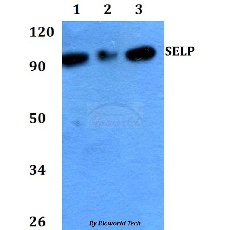 Anti-SELP Antibody from Bioworld Technology (BS60726) - Antibodies.com
