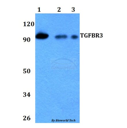 Anti-TGFBR3 Antibody from Bioworld Technology (BS60728) - Antibodies.com