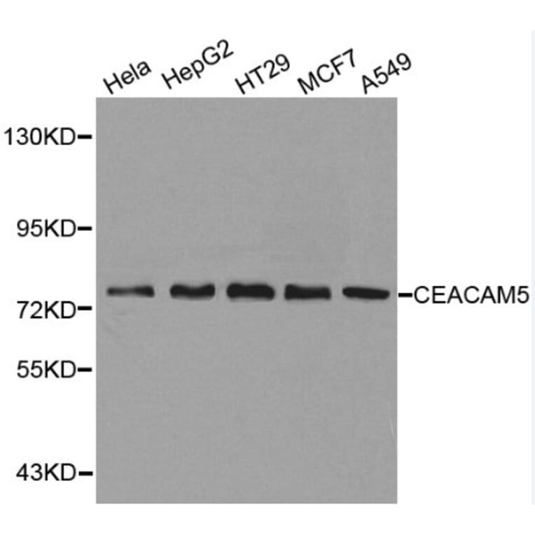 Anti-CEACAM5 Antibody from Bioworld Technology (BS6073) - Antibodies.com