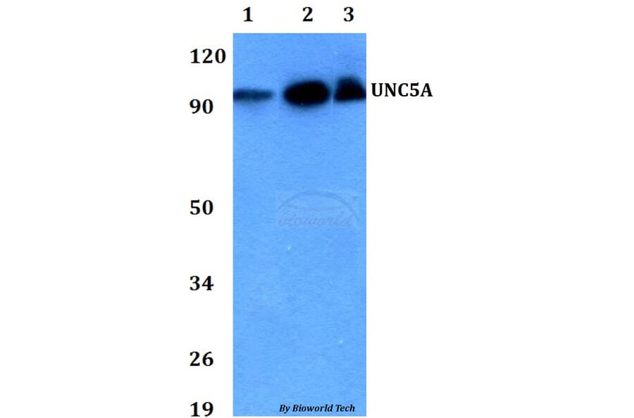 Anti-UNC5A Antibody from Bioworld Technology (BS60730) - Antibodies.com