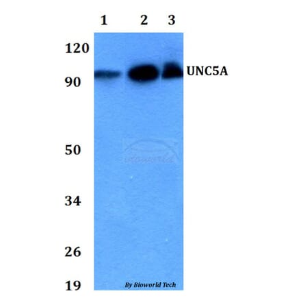 Anti-UNC5A Antibody from Bioworld Technology (BS60730) - Antibodies.com