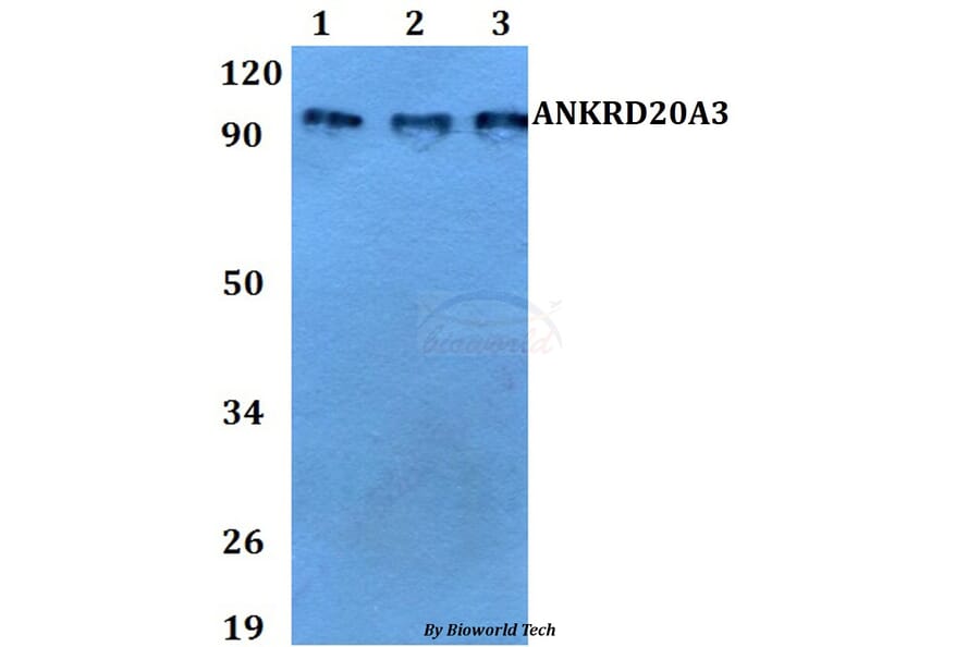 Anti-ANKRD20A3 Antibody from Bioworld Technology (BS60731) - Antibodies.com