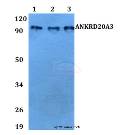 Anti-ANKRD20A3 Antibody from Bioworld Technology (BS60731) - Antibodies.com