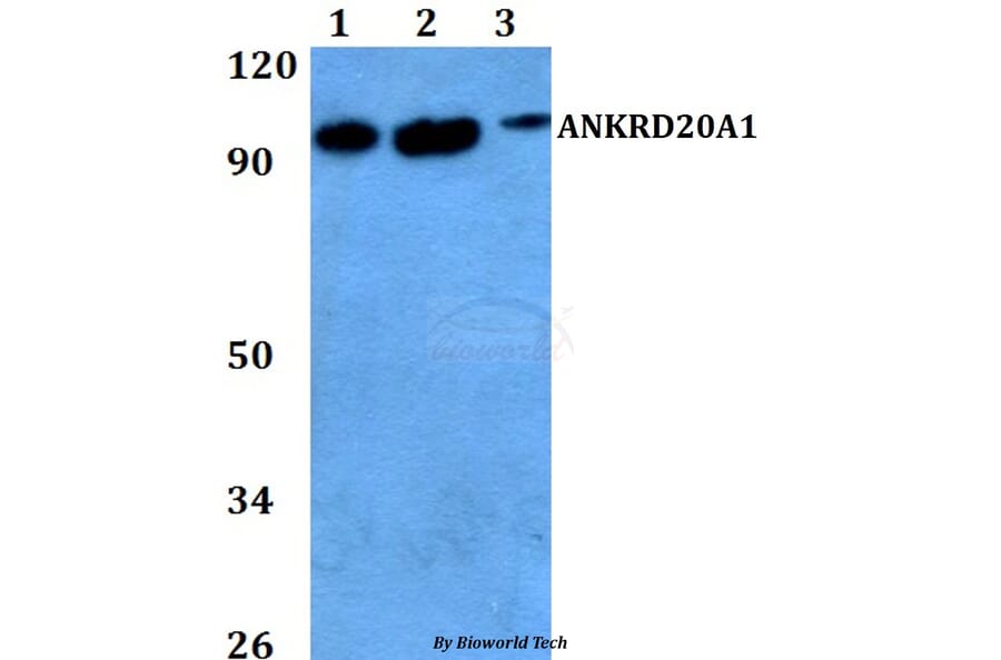 Anti-ANKRD20A1 Antibody from Bioworld Technology (BS60736) - Antibodies.com