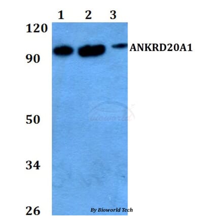 Anti-ANKRD20A1 Antibody from Bioworld Technology (BS60736) - Antibodies.com
