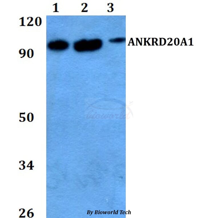 Anti-ANKRD20A1 Antibody from Bioworld Technology (BS60736) - Antibodies.com