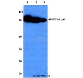 Anti-ATP6V0A2 Antibody from Bioworld Technology (BS60737) - Antibodies.com