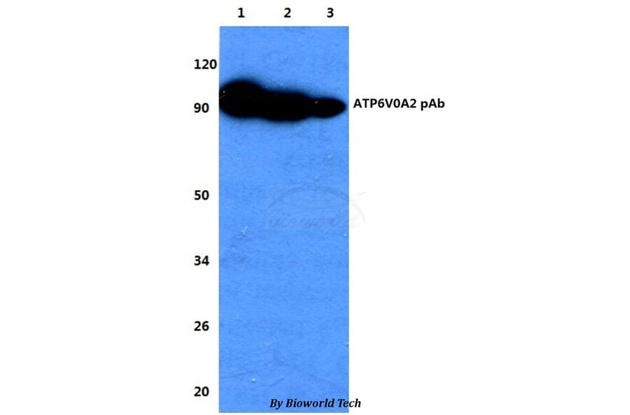 Anti-ATP6V0A2 Antibody from Bioworld Technology (BS60737) - Antibodies.com
