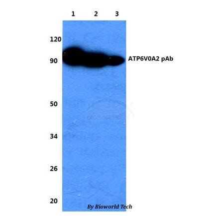 Anti-ATP6V0A2 Antibody from Bioworld Technology (BS60737) - Antibodies.com