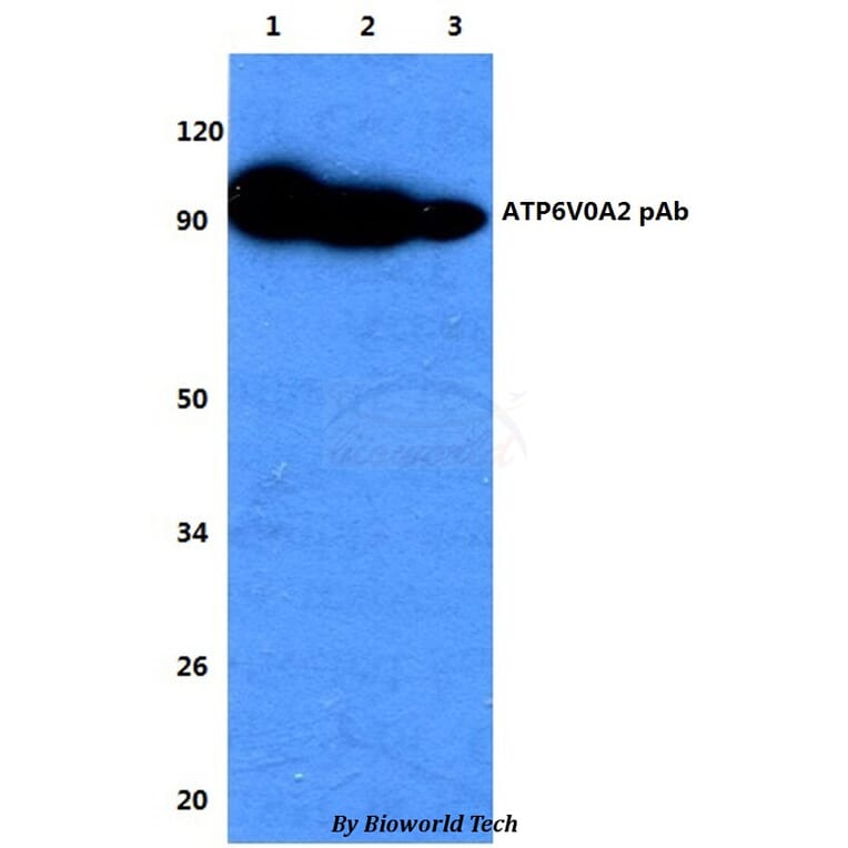 Anti-ATP6V0A2 Antibody from Bioworld Technology (BS60737) - Antibodies.com