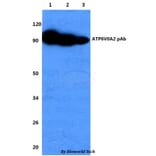 Anti-ATP6V0A2 Antibody from Bioworld Technology (BS60737) - Antibodies.com