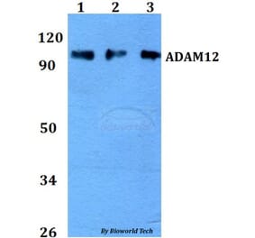 Anti-ADAM12 Antibody from Bioworld Technology (BS60740) - Antibodies.com