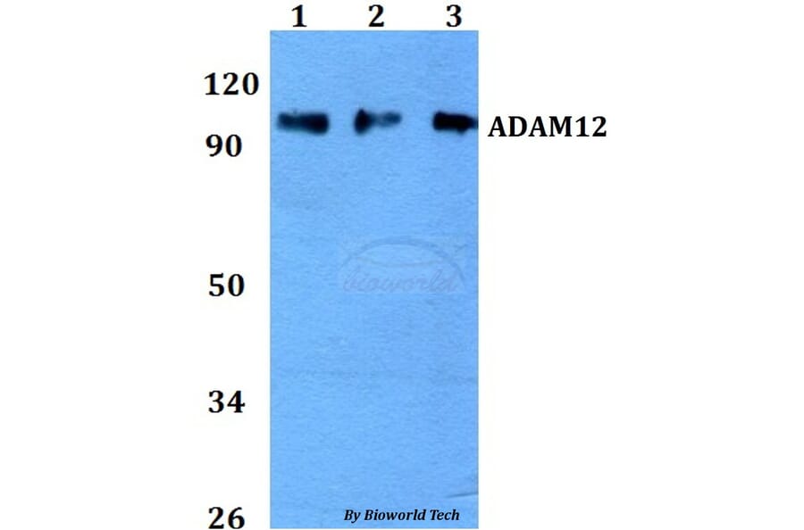 Anti-ADAM12 Antibody from Bioworld Technology (BS60740) - Antibodies.com