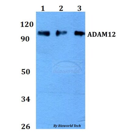 Anti-ADAM12 Antibody from Bioworld Technology (BS60740) - Antibodies.com