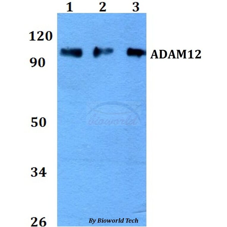 Anti-ADAM12 Antibody from Bioworld Technology (BS60740) - Antibodies.com