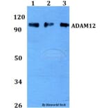 Anti-ADAM12 Antibody from Bioworld Technology (BS60740) - Antibodies.com