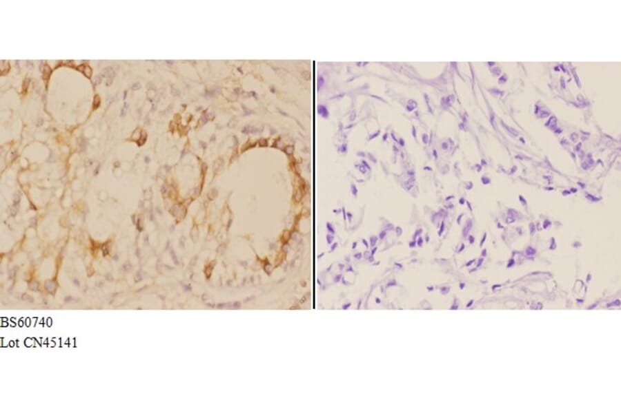 Anti-ADAM12 Antibody from Bioworld Technology (BS60740) - Antibodies.com