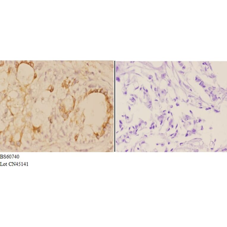 Anti-ADAM12 Antibody from Bioworld Technology (BS60740) - Antibodies.com