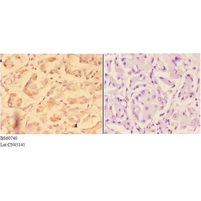 Anti-ADAM12 Antibody from Bioworld Technology (BS60740) - Antibodies.com