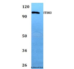 Anti-ITIH3 Antibody from Bioworld Technology (BS60741) - Antibodies.com