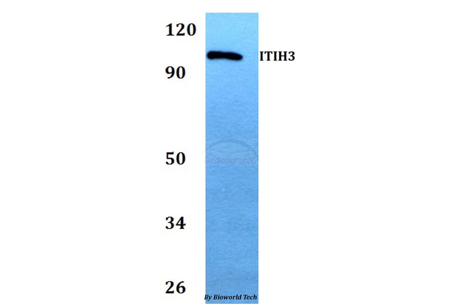 Anti-ITIH3 Antibody from Bioworld Technology (BS60741) - Antibodies.com