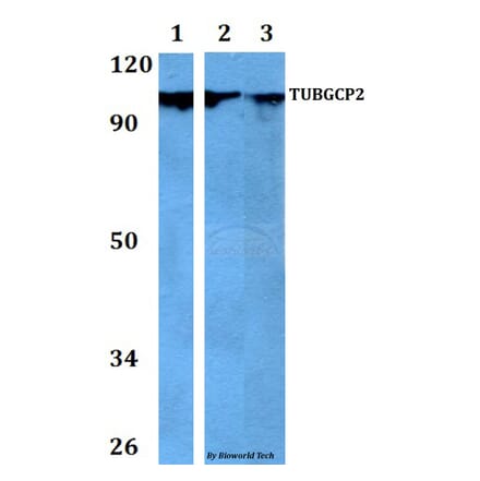 Anti-TUBGCP2 Antibody from Bioworld Technology (BS60743) - Antibodies.com