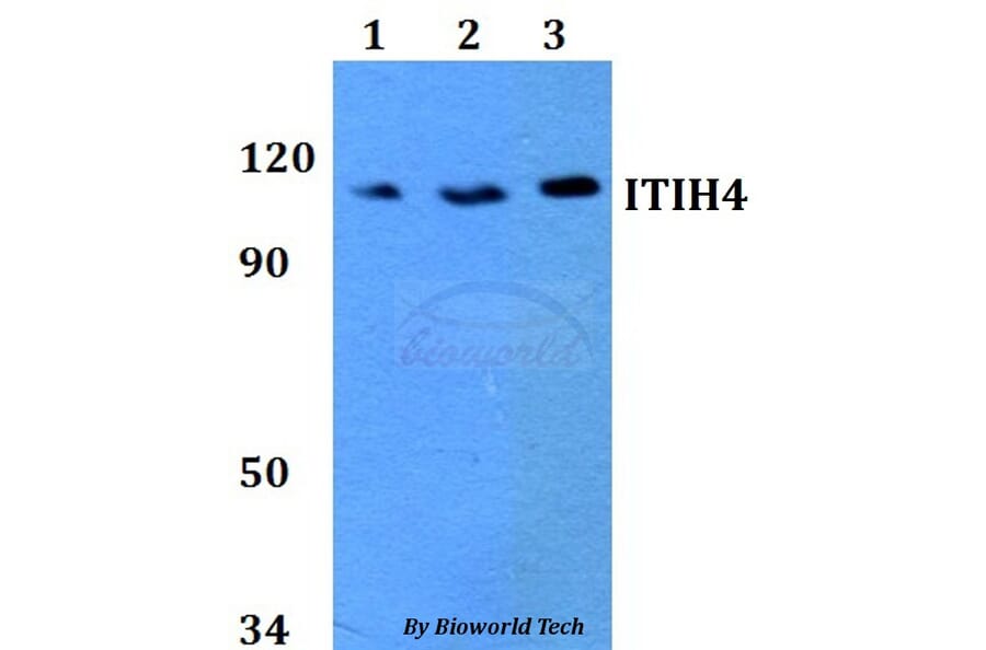 Anti-ITIH4 Antibody from Bioworld Technology (BS60746) - Antibodies.com