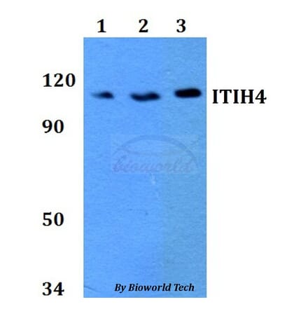 Anti-ITIH4 Antibody from Bioworld Technology (BS60746) - Antibodies.com