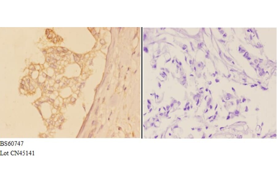 Anti-ADAM19 Antibody from Bioworld Technology (BS60747) - Antibodies.com