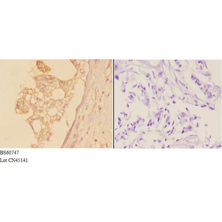 Anti-ADAM19 Antibody from Bioworld Technology (BS60747) - Antibodies.com