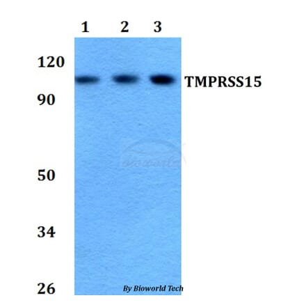 Anti-TMPRSS15 Antibody from Bioworld Technology (BS60752) - Antibodies.com