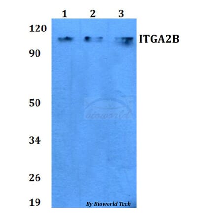 Anti-ITGA2B Antibody from Bioworld Technology (BS60753) - Antibodies.com