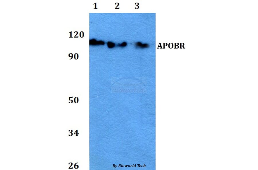Anti-APOBR Antibody from Bioworld Technology (BS60755) - Antibodies.com