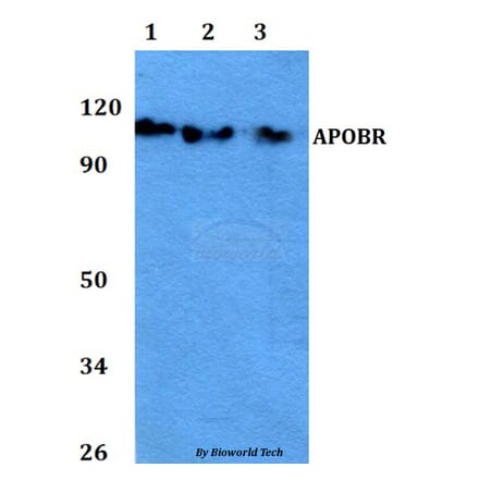 Anti-APOBR Antibody from Bioworld Technology (BS60755) - Antibodies.com