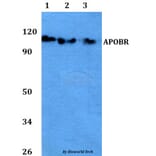 Anti-APOBR Antibody from Bioworld Technology (BS60755) - Antibodies.com