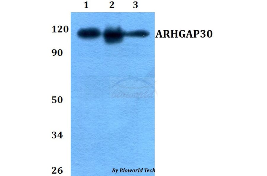 Anti-ARHGAP30 Antibody from Bioworld Technology (BS60757) - Antibodies.com