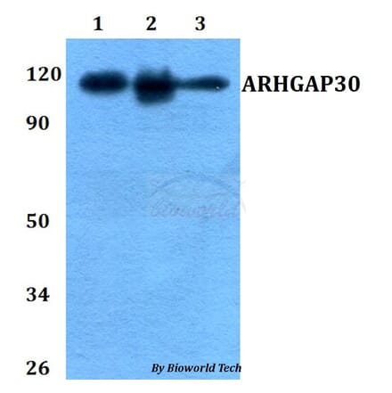 Anti-ARHGAP30 Antibody from Bioworld Technology (BS60757) - Antibodies.com