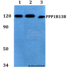 Anti-PPP1R13B Antibody from Bioworld Technology (BS60759) - Antibodies.com