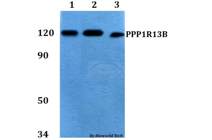 Anti-PPP1R13B Antibody from Bioworld Technology (BS60759) - Antibodies.com