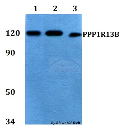 Anti-PPP1R13B Antibody from Bioworld Technology (BS60759) - Antibodies.com