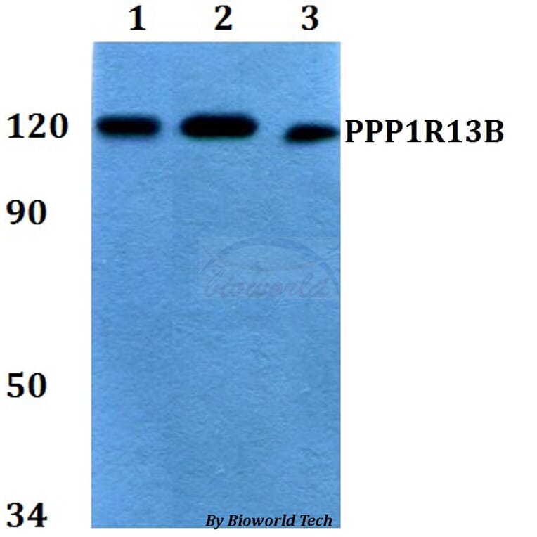 Anti-PPP1R13B Antibody from Bioworld Technology (BS60759) - Antibodies.com