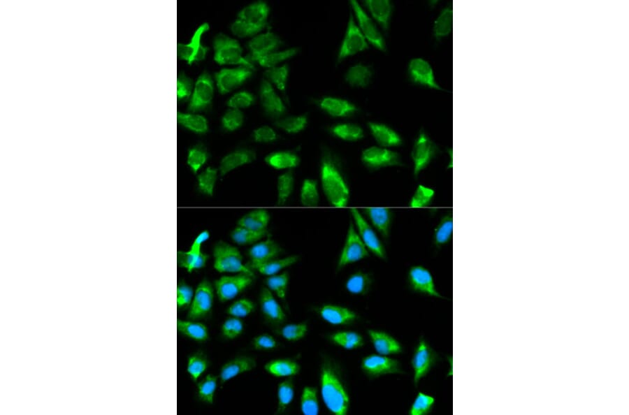 Anti-TRAF6 Antibody from Bioworld Technology (BS6076) - Antibodies.com