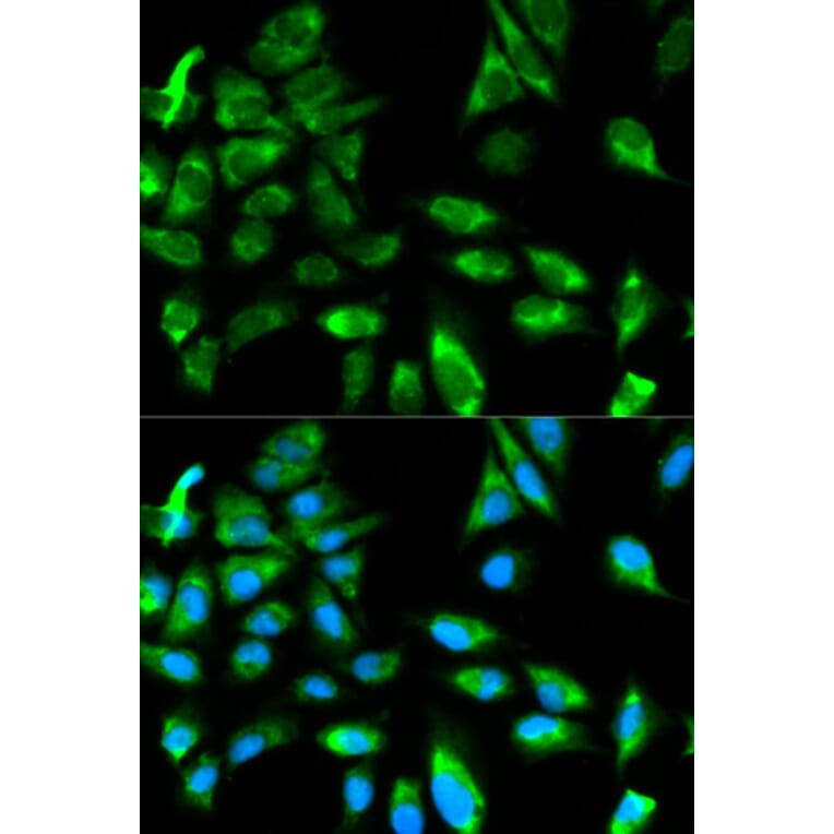 Anti-TRAF6 Antibody from Bioworld Technology (BS6076) - Antibodies.com