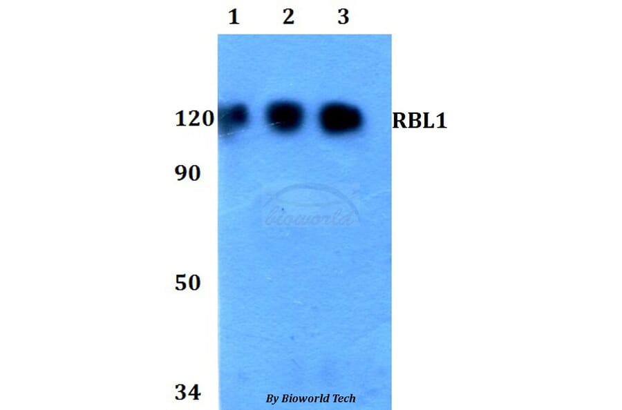 Anti-RBL1 Antibody from Bioworld Technology (BS60760) - Antibodies.com